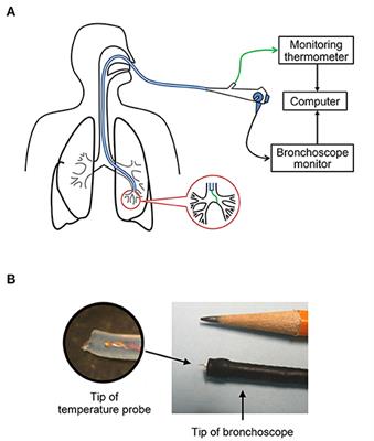 A Distinct Difference Between Air and Mucosal Temperatures in Human Respiratory Tract